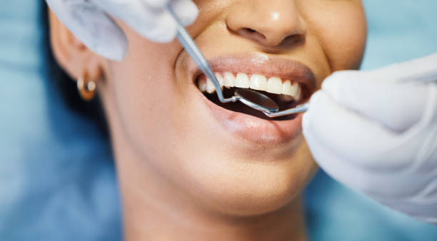 Best Emergency Gum Treatment in West Bend, WI