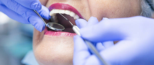 Best Emergency Root Canal Treatment in West Bend, WI